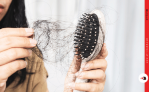 hair fall solution for women
