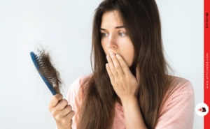 Types of Hair Fall and Their Effective Treatments
