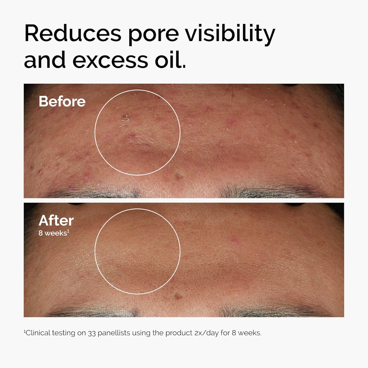 Key Benefits of Ordinary Serum
